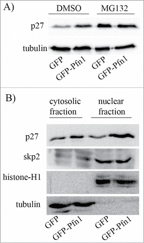 Figure 1. Pfn1 overexpression causes p27 accumulation in MDA-231 cells through inhibiting its protein turnover. (A) P27 immunoblot of total cell extracts prepared from sub-confluent cultures of GFP- and GFP-Pfn1-expressing MDA-231 cells following treatment with 10 μM of either MG-132 (a proteasome inhibitor) or DMSO (vehicle control) for 10 hours. Tubulin blot serves as a loading control. (B) P27 and skp2 immunoblots of cytosolic and nuclear extracts prepared from GFP- and GFP-Pfn1-expressors (tubulin and histone blots served as loading control for cytosolic and nuclear fractions, respectively). These data are representative of 2–3 independent experiments.