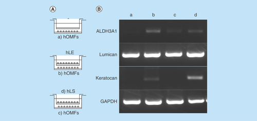 Figure 5.  Differentiation of human oral mucosa middle interstitial tissue fibroblasts into cells with a keratocyte phenotype.(A) Illustrated cultivation methods of hOMFs with hLE cells and hLS cells. (B) Comparison of keratocyte phenotype in each cell type by reverse transcription PCR. GAPDH was used as an internal control. (a) hOMFs alone. (b) hOMFs cocultured with hLE. (c) hOMFs cocultured with hLS. (d) hLS cocultured with hOMFs.GAPDH: Glyceraldehyde-3-phosphate dehydogenase; hLE: Human limbal epithelial cell; hLS: Human limbal stromal cell; hOMF: Human oral mucosa middle interstitial tissue fibroblast.