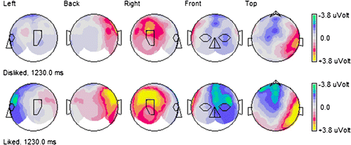Figure 5. Topographical maps demonstrating a most pronounced LPP over the right parietal cortical area in response to liked brands.
