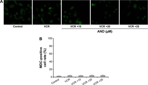 Figure 3 Cell growth inhibition induced by AND plus VCR was not dependent on autophagy.
