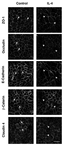 Figure 3. IL-4 disrupts apical junctional complex structures. 16HBE cells were incubated with IL-4 (50 ng/ml for 72 h) followed by analysis of AJC structure using immunofluorescence and antibodies directed against ZO-1, Occludin, E-Cadherin, β-Catenin or Claudin- 4. Results are from one experiment representative of n = 2. Scale bar = 30 microns.