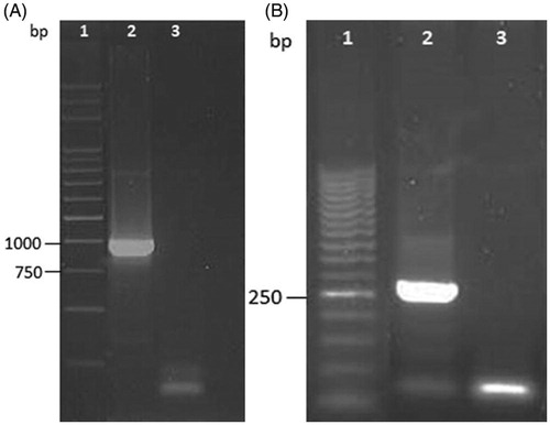 Figure 1. (A) Agarose gel (1%) one-dimensional electrophoresis of PCR products for the detection of FedF gene from genomic DNA of O138 Escherichia coli strain. Lane 1: marker 1 kb; lane 2: positive sample; lane 3: negative control sample. (B) Agarose gel (1.5%) one-dimensional electrophoresis of PCR products for the detection of VT2eB gene from genomic DNA of O138 Escherichia coli strain. Lane 1: marker 50 pb; lane 2: positive sample; lane 3: negative control sample.