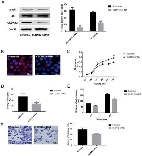Figure 3 Loss of CLDN12 decreased the migration ability of osteosarcoma cells. (A) Western blotting was used to examine the effects of silencing CLDN12 and the activation of the Akt signaling pathway in the Saos2 cell line. (B) The expression location of CLDN12 was detected via immunofluorescence. The CLDN12 protein was stained with red color and the nuclear was stained with blue color. (C) Growth curve of Saos2 cells detected by the CCK-8 assay. (D) The abilities of Saos2 cells to form colonies under 2D culture conditions were determined via a colony formation assay. (E) The wound-healing assay was utilized to explore the migration ability of Saos2 cells in vitro. (F) Transwell chambers were utilized to explore the impact of CLDN12 silence on the migratory ability of Saos2 cells in vitro. **P<0.01, compared with the scramble group.Abbreviations: CLDN12, claudin-12; CCK-8, Cell Counting Kit-8.