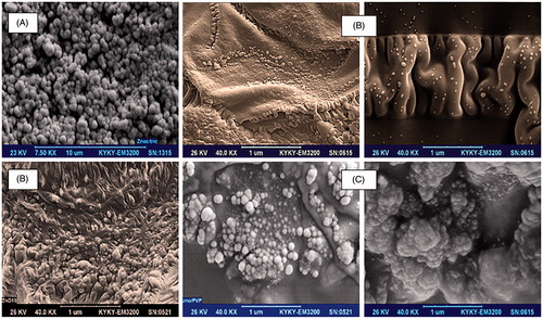 Figure 9. SEM images of spherical shape ZnO NPs with unmodified surfaces by a carboxylic acid agent (A). SEM images of ZnO QD NPs in different shapes (nanospherical and nanorods) in eco-friendly green fatty carboxylic acid layers. They can generate smart surfaces for targeted attacking ZnO NPs to bacterial cell walls or cell membrane of cancerous cell lines, and this is a fantastic point for diffusion of NPs as the strong attacker (B). SEM images of very beautiful and attractive ZnO NPs as unique synergistic agents in nanofluids which their surfaces were modified by PVP food polymer (C).