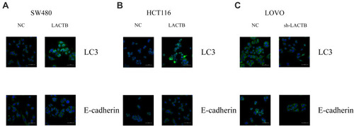 Figure 3 LACTB inhibits EMT and promotes autophagy in CRC, as demonstrated by immunofluorescence. (A–C) Immunofluorescence results revealed that E-cadherin expression was enhanced in LACTB-overexpressing SW480 and HCT116 cell lines and dysregulated in LACTB-knockdown LOVO cells compared with control cells transfected with a nonspecific lentivirus. The upregulation of LACTB expression in SW480 and HCT116 cells significantly elevated the LC3-II/LC3-I ratio, and the knockdown of LACTB expression in LOVO cells decreased the LC3-II/LC3-I ratio and the E-cadherin level.