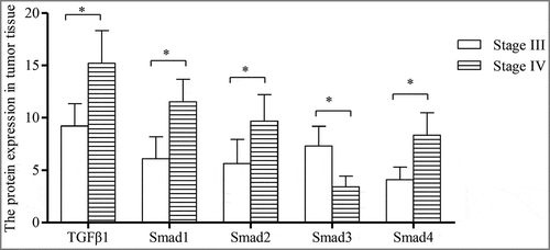 Figure 5 The correlation of the protein expression of TGFβ1 and Smad1-4 with pathological stages and CD105 expression in tumor tissues (n = 50). *indicated P < 0.05 in comparison between groups.