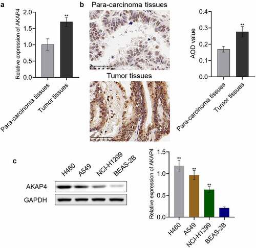 Figure 1. A high expression level of AKAP4 was observed in both clinical NSCLC tissues and NSCLC cell lines. (a). RT-PCR was used to determine the gene expression level of AKAP-4 in the NSCLC tissues and para-carcinoma tissues. (b). Immunohistochemical assay was used to determine the protein expression level of AKAP-4 in the NSCLC tissues and para-carcinoma tissues (**p < 0.01 vs. para-carcinoma tissues). (c). Western blotting assay was used to determine the expression level of AKAP4 in the NSCLC cell line and HEAS-2B cells (**p < 0.01 vs. HEAS-2B cells).