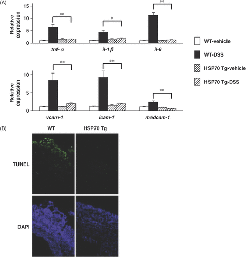 Figure 3. The mRNA expression of various genes and levels of cell death in colonic mucosa. Transgenic mice expressing Hsp70 (Hsp70 Tg) and wild-type mice (WT) were treated with or without 3% DSS for 7 days (A, B). Relative mRNA expression of each gene in colonic tissues was monitored and expressed. Values are mean ± SEM (n = 3–6). **P < 0.01; *P < 0.05 (A). Sections of colonic tissues were prepared and subjected to TUNEL assay and DAPI staining (B). This figure was published previously and is reprinted here with permission of the journal Citation[23].