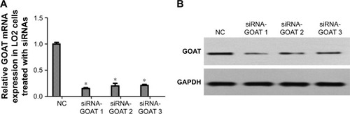 Figure 1 Effect of siRNAs on reducing GOAT expression in mRNA and protein levels.