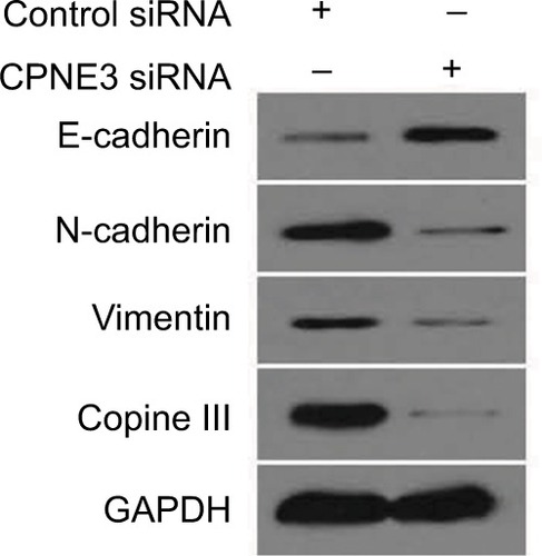 Figure 8 Silencing copine-III modulates the expression of epithelial–mesenchymal transition (EMT) indicators.Notes: MHCC97-H cells, infected with control siRNA or siCPNE3, were harvested and analyzed by Western blotting assays. The expression of copine-III, E-cadherin, N-cadherin, or vimentin was detected via their antibodies. GAPDH was chosen as a loading control.