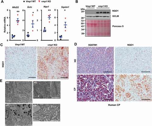 Figure 5. Increased NFE2L2 activation in pancreatic acinar-cell specific vmp1 KO mice and increased SQSTM1 and ER stress in human CP. Two-months old Tg(Cela1-cre/ERT)/BAC-Ela-Cre−; Vmp1f/f (Vmp1 WT) and Tg(Cela1-cre/ERT)/BAC-Ela-cre+; vmp1f/f (vmp1 KO) mice were injected with tamoxifen (75 mg/kg) once a day for consecutive 3 days, and these mice were sacrificed 5 days after the last injection of tamoxifen. (A) mRNA was extracted from pancreatic tissues followed by qPCR analysis. Results were normalized to Rpl13a and expressed as fold change compared to VMP1 WT group. Data shown are mean ± SE (n = 3–4). *p < 0,05; **p < 0,01; Student t-test analysis. (B) Immunoblotting analysis using total lysates from pancreatic tissues. (C) Representative images of immunohistochemistry staining of NQO1 from 2-months old WT and Vmp1 KO mouse pancreatic tissues. (D) Representative images of IHC staining for SQSTM1 and NQO1. Bar: 100 µm. (E) Representative EM images of human ND and CP tissues are shown. Bar: 2 µm.