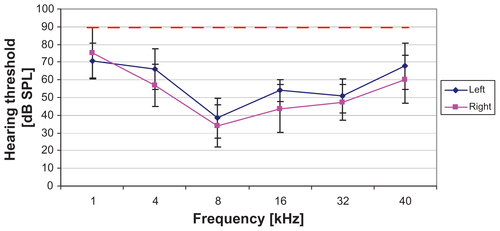 Figure S1 By frequency-specific AABR measurements on day 0, a normal hearing threshold was detected in all animals (blue and pink line; mean ± SD).Notes: The results of the measurements on day 7 and day 21 are plotted as a red line. None of the animals had residual hearing after the deafening procedure. The hearing threshold of all animals was 90 dB SPL or above on day 7 and did not recover until the final measurement on day 21.Abbreviations: AABR, acoustically evoked auditory brainstem response; SD, standard deviation.