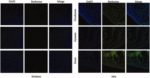 Figure 5. CLSM images of different segments of the small intestine. CLSM images showing the absorption of (A) BBR and (B) PEG–lipid–PLGA NPs/BBR–SPC in different segments of the small intestine. DAPI was used to label the cell nuclei (blue).