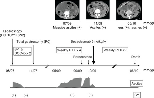 Figure 4 Treatment and disease progression for the presented case.