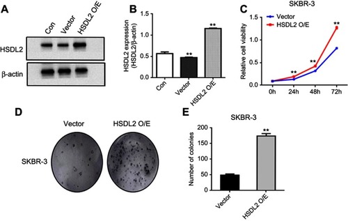 Figure S1 Overexpression of HSDL2 promotes the proliferation of breast cancer cells.Notes: (A–B) SKBR-3 cells were transfected with HSDL2 overexpression plasmid. The transfection efficiency was confirmed by Western blot. (C–E) The proliferation capability of the transfected cells was detected by MTT and colony formation assays. Data are shown as the mean ± SEM from three independent experiments (*p<0.05; **p<0.01).