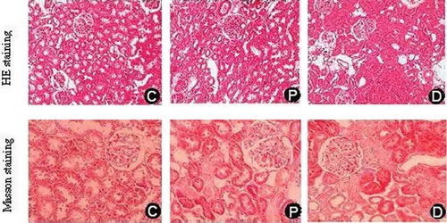 Figure 1.  Comparison of renal histopathological changes at the end of 12th week in each group (HE × 100 and Masson × 200). C, control group; P, diabetic group under probucol therapy; D, diabetic group.