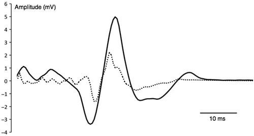 Figure 4. Example of motor evoked potential (MEP) by transcranial magnetic stimulation (TMS) for one subject. Curves represent the average of 3 MEP recorded during the fourth test session (T4) in neutral (plain line) and hot (dashed line) environment.