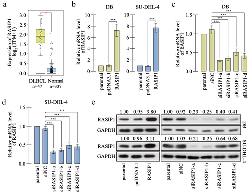 Figure 1. RASIP1 was increased in DLBCL specimens.