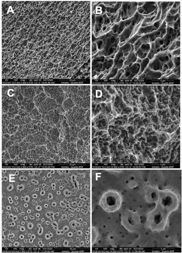 Figure 3 Scanning electron microscopy (SEM) micrographs of implants surface. (A and B) Hanano; (C and D) SLActive, and (E and F) TiUnite. (A, C and E) at 3000× magniﬁcation (scale bar = 30 μm) and (B, D and F) 15,000 x magnification (scale bar = 5 μm).