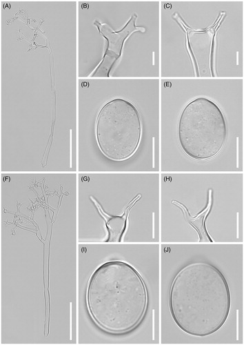Figure 3. Morphological characteristics of two Plasmopara species, Pl. angustiterminalis ex Xanthium strumarium (A–E) and Pl. siegesbeckiae ex Siegesbeckia glabrescens (F–J). (A & F), Sporangiophores; (B, C, G, H), Ultimate branchlets; (D, E, I, J), Sporangia (scale bars: 100 µm for sporangiophores, 10 µm for ultimate branchlets, and 10 µm for sporangia).