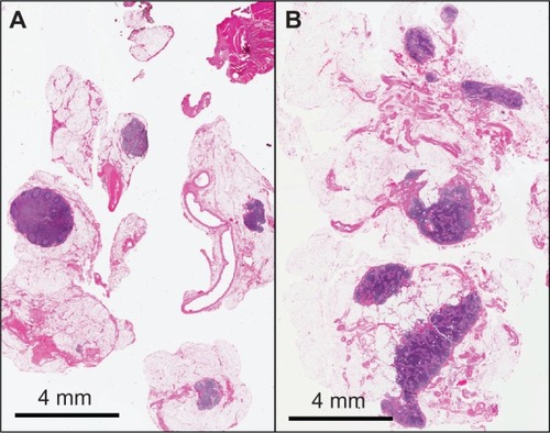 Figure 1 Images of two histopathological lymph node slides.