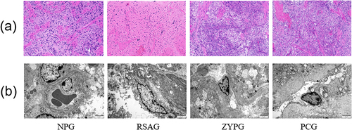 Figure 3 The changes in pathological morphology of decidual tissues and ultrastructure of vascular endothelial cells in vivo. (a) The pathological morphology of decidual tissues observed by HE staining (200×). Scale bar, 1mm. (b) The ultrastructure of vascular endothelial cells observed by using TEM (10,000×). Scale bar, 2μm.