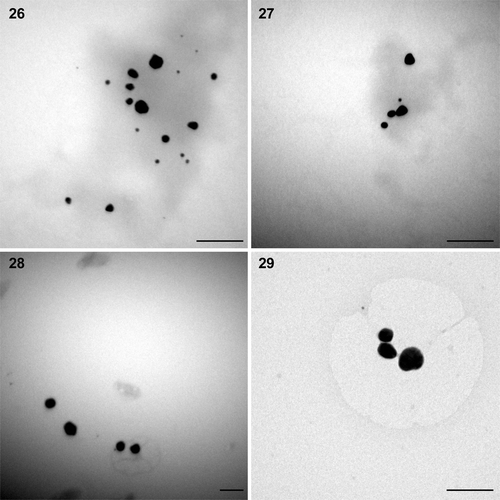 Figs 26–29. TEM microphotographs of gold nanoparticles synthesized by Phormidium tenue and Ulva intestinalis biomass. 26, 27. Spherical to somewhat irregular‐shaped particles produced by P. tenue at pH 5. 28, 29. Larger particles with irregular surfaces produced by Ulva intestinalis at pH 5. Scale bars: 100 nm.