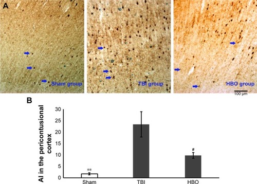 Figure 1 Apoptotic cells in pericontusional cortices of mice.