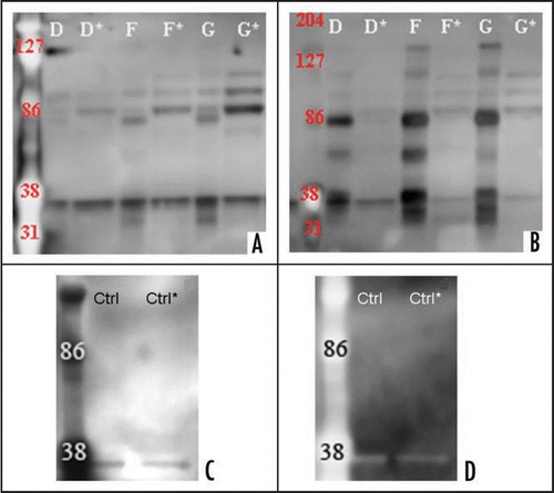 Figure 7 Western blot analysis of CJD and control urine samples after Protein-A column chromatography. Two sCJD, one vCJD and one control urine sample were loaded on Protein-A column, eluates and flow-throughs were collected, enriched and PK digested (60 µg/ml for 30 min). Samples were subsequently electrophoresed and Western blotted. Sample IDs correspond to Table 1. Eluate is displayed with a capital letter and the flow-through with and additional (*). Healthy control is indicated with ‘Ctrl’. (A and C) Proteolytic treatment of urine samples from CJD and healthy control with proteinase K (concentration 60 µg/ml for 30 min). Proteins were transferred with a Bio-Rad instrument and the membrane probed with 3F4-HRP followed with ECL Plus. Membrane documentation was with a Kodak Imager with 5 minutes exposure time. (B and D) the membrane was stripped for 35 minutes at 37°C, verified for the removal of previously used antibody. The membrane was then probed with anti-IgG-HRP and ECL Plus was added for chemiluminescence. Membrane documentation was with a Kodak Imager with 5 minutes exposure time.