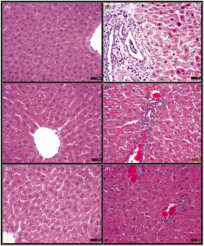 Figure 4. Histochemical localization by H & E staining of the liver of (A) control (0.9% NaCl), (B) NDMA treated, (C) FESB (150 mg/kg), (D) NDMA+ FESB (150 mg/kg treated), (E) FESB (300 mg/kg treated) and (F) NDMA+ FESB (300 mg/kg) treated experimental animals. Biopsies of liver from Group A showing normal structure Bar: 20 μ. Section of the liver from Group B rats reveals liver hyperaemic, sinusoidal dilatation, perivascular cell infiltration, fibrosis in the portal area, degeneration and necrosis in the hepatocytes Bar: 20 μ. Section of liver from Group C, normal histologic structure. Section of liver from Group D, a small number of perivascular cell infiltration, hyperaemia, degeneration in the hepatocytes. Section of liver from Group E, rats showing normal histologic structure. Section of liver from Group F, decreased degree of degeneration in the hepatocytes and liver hyperemic Bar: 20 μ.