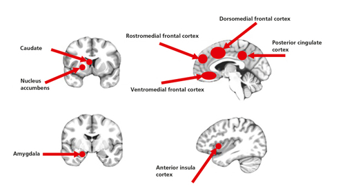 Figure 1. Regions implicated in emotional and reward-related processing. These regions have been implicated as critical  for specific functional processes and selectively interact to allow specific functional processes to occur. Studies have reported  dysfunctional responses within these regions in adolescents with conduct problems and adults with psychopathy during  emotional and reward-related processing.