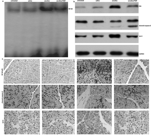 Figure 3. Changes in pancreatic levels of NF-Kb P65 nuclear transcription, Bcl-2 protein expression and caspase-3 activation in models of acute pancreatitis. (a), EMSA assay; (b), western blot assay; (c), Immunohistochemistry (IHC).