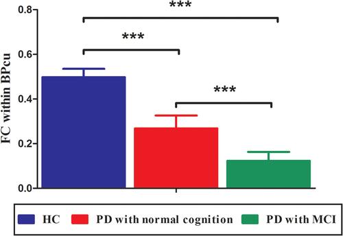 Figure 3 Group-level differences of the disease-related differences in DMN. Compared to PD patients with normal cognition and PD patients with MCI, the HCs showed significantly increased FC within BPcu. Further, there was also significant difference regarding the FC within BPcu between the two PD groups. ***Indicate P < 0.001.