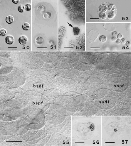 Figs 50–57. Life-cycle of Ochrosphaera neapolitana. Fig. 50. Aspects of the S-cell generation. Cells are naked and have the same cytological characteristics as coccolith-bearing cells. Fig. 51. Mucilage coating surrounding S-cells highlighted by staining with ruthenium red. Fig. 52. Contrasting aspects of colonies of each generation grown on agar. C-cell colonies (arrow) are compact and dark in colour; S-cell colonies are more dispersed and lighter. Fig. 53. Tetrad (= meiocyst; compare with Fig. 7) preceding the reappearance of S-cells. Fig. 54. Naked S-cells released from the meiocyst. Fig. 55. Scales characteristic of the S-cell generation. The most abundant scales are irregular in shape and cover the plasmalemma (basal scales). The proximal faces (bspf) have radial fibres in quadrants and their distal faces (bsdf) have concentric fibres. Both faces of the superficial scales are also seen. The proximal faces (sspf) of these scales have radiating fibres and a thin rim; the distal faces (ssdf) have concentric fibres that are difficult to resolve. Figs 56, 57. Metaphase chromosomes fixed and stained with lactopropionic orcein. Fig. 56. Diploid C-cell with 20 ± 1 chromosomes. Fig. 57. Haploid S-cell with 10 ± 1 chromosomes. Scale bars represent 10 µm (Figs 50, 51, 53, 54), 50 µm (Fig. 52), 0.5 µm (Fig. 55) and 5 µm (Figs 56, 57).