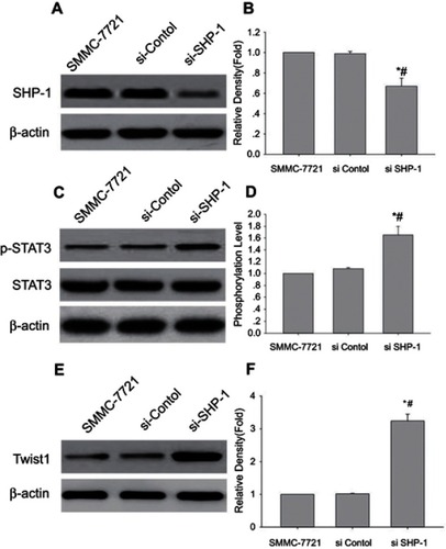 Figure 5 Knockdown of SHP-1 induced the p-STAT3 and Twist1 expression. Western blot analysis has performed the levels of SHP-1, p-STAT3 (Tyr705) and Twist1 in SMMC-7721 cells transfected with SHP-1 siRNA; β-actin was used as an internal control. (A, C, and E) Representative blot from three independent experiments. (B, D, and F) relative density or phosphorylation level (Mean ± SD, n=3); *p<0.05 vs SMMC-7721 cell line; #p<0.05 vs SMMC-7721 cell line transfected with control.