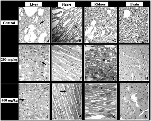 Figure 14. Histopathological analysis of the effect of G. acerosa on mice treated with 200 and 400 mg/kg bw. A, B, C, & D – Control group; E,F,G&H – 200 mg/kg bw G. acerosa-treated group, IJKL - 400 mg/kg bw G. acerosa treated group. A,E & I Display full size - Liver section showing normal hepatocellular arrangement with intact membrane. B,F & J Display full size - Heart section showing normal fibre integrity and cell alignment. C, G & K Display full size - Kidney section showing normal interstitium. D, H & L Display full size – Brain section shows normal interneuronal space with normal cellular integrity.