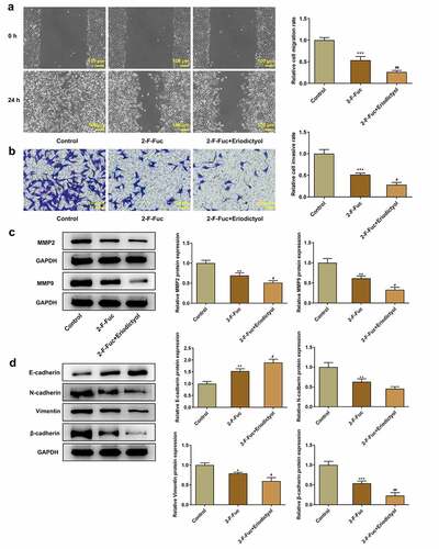 Figure 7. Eriodictyol treatment suppresses migration, invasion, and EMT of CRC cells by downregulating TSTA3 expression to restrain fucosylation. HCT116 cells were treated with 2-F-Fuc or co-treated with 2-F-Fuc and eriodictyol. (a) Wound healing assay was employed to detect CRC cell migration. (b) Transwell invasion assay was employed to detect CRC cell invasion. (c) Western blot analysis was employed to detect the levels of MMP2 and MMP9 in CRC cells. (d) Western blot analysis was employed to detect the levels of E-cadherin, N-cadherin, Vimentin, and β-cadherin in CRC cells. * p < 0.05, ** p < 0.01, *** p < 0.001 versus Control; # P < 0.05, ## P < 0.01 versus 2-F-Fuc.