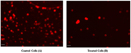 Figure 4. The microphotographs obtained by fluorescence microscopy indicate changes in mitochondrial membrane potential (MMP). (A) Untreated HT29 cells were used as a control. (B) HT29 cells showed significant changes in mitochondrial membrane potential (MMP) after treatment with CeO2-NCs. Bars = 10 μm.