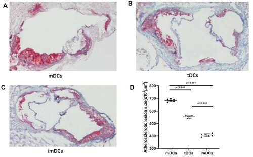 Figure 8 GARP-tDCs ameliorate atherosclerosis in ApoE−/- mice. (A) The atherosclerotic lesion size in the mDC group. (B) The atherosclerotic lesion size in the GARP-tDC group. (C) The atherosclerotic lesion size in the imDC group. (D) The atherosclerotic lesion size in three groups was quantified by Image Pro. n=6 per group. The black bar represents 100μm. **P<0.001.