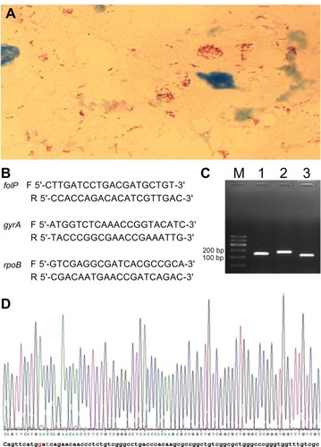 Figure 1 (A) Microscopic observation of numerous acid fast bacilli (red rods) in the slit skin smear fluid from a solitary lesion in the face at the initial presentation of the patient. Original magnification: ×1,000. (B) primers used in this study. The letters F and R refer to forward and reverse primer, respectively. (C) Amplification products of folP, gyrA, and rpoB genes (lanes 1–3, respectively). (D) A mutation of codon 441 of the rpoB gene was found (GAt→AAC) (indicated in red).