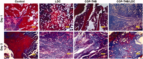 Figure 12. Preliminary safety evaluation of COP–THB/LDC formulations. Rats were subcutaneously injected with COP–THB/LDC, COP–THB, or saline, then skin sections were prepared on days 1 and 5 after injection and stained with Masson's trichrome stain (MTS). Scale bar, 100 μm.