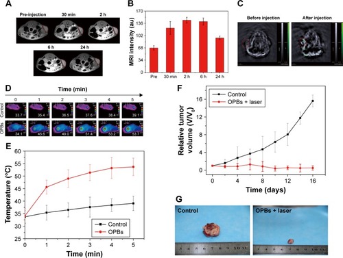 Figure 6 Dual-mode imaging and photothermal therapy of OPBs for tumor in vivo.Notes: (A) T1-weighted imaging in 4T1 tumor-bearing mice before and after intravenous injection of OPBs at different time points. (B) The corresponding of MR signal intensities at the tumor area. (C) Photoacoustic imaging of 4T1 tumor-bearing mice before and after injection of OPBs. (D) Thermal imaging of 4T1 tumor-bearing mice before and after injection with normal saline (control) or OPBs followed by 808 nm laser irradiation for 5 min. (E) Corresponding temperature change curves at tumor sites. (F) Relative tumor volume growth curves and (G) representative dissected tumor digital photos of 4T1 tumor bearing mice after PTT. (H) Changes in body weight during PTT. (I) H&E stained slices of tumor tissues collected from different groups after treatment (Magnification, ×200).Abbreviations: OPBs, optimized Prussian blue nanoparticles; MRI, magnetic resonance imaging; PTT, photothermal therapy; H&E, hematoxylin-eosin.