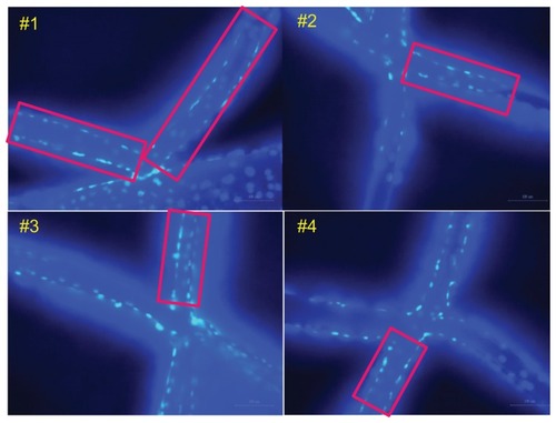 Figure 9 Scaffolds for cell cover ratio estimation.