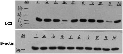 Figure 1. A–E respectively on behalf of the blank control group; 6.25 µg/mL SN50 group; 12.5 µg/mL SN50 group; 25 µg/mL SN50 group and 50 µg/mL SN50 group. F–J is repeated A–E.