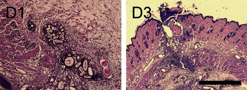 Figure 14 Wound healing in hEGF/lidocaine-incorporated nanofibers at post-surgical days 1 and 3 (scale bar: 1 mm). A foreign body reaction was noted at day 1 (D1), while fibroblastic proliferation and mixed infiltrates of lymphocytes and plasma cells were observed in the subcutis and muscular layer on day 3 (D3).Abbreviation: hEGF, human epidermal growth factor.