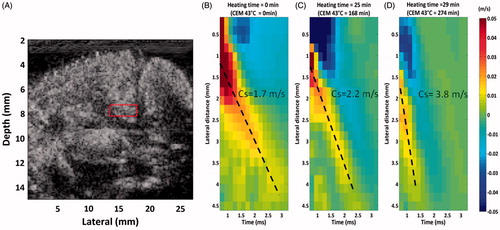 Figure 3. Variation of shear wave velocity as a function of temperature, as assessed using shear wave elastography. © 2011 Institute of Physics and Engineering in Medicine. Reproduced by permission of IOP Publishing from Sapin-de Brosses et al. [Citation105]. All rights reserved.