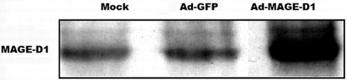 Figure 1 MAGE-D1 protein expression analyzed by Western blot. Ad-MAGE-D1 infection led to a marked over-expression of MAGE-D1 compared to mock- and Ad-GFP-infected HeLa cells.