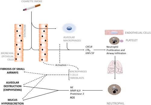 Figure 2. Cellular interactions in COPD pathogenesis.Inhaled irritants such as cigarette smoke stimulate bronchial epithelial cells and alveolar macrophages to secrete factors (CXCL8, LTB4, GM-CSF) that promote both neutrophil production in bone marrow and neutrophil migration towards inflamed airways, a process coordinated by activated platelets, endothelial cells and the neutrophil. Neutrophils infiltrate the airways in large numbers and produce serine proteases and elastolytic enzymes (e.g. NE, MMP-8,9, proteinase-3). These neutrophilic enzymes act alongside other activated immune cells (dotted line) to degrade alveolar tissue leading to emphysema, over-stimulate Goblet cells leading to hypersecretion of mucus, and cause fibrosis of the small airways, all of which are hallmark features of COPD. CXCL8, Chemokine (CXC motif) ligand 8; LTB4, Leukotriene B4; GM-CSF, Granulocyte-Macrophage Colony-Stimulating Factor; NE, Neutrophil Elastase; MMP, Matrix Metalloproteases.