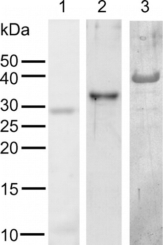 Fig. 3. SDS–PAGE of recombinant PpChis.