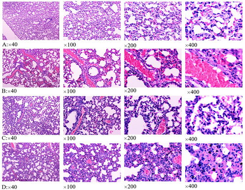 Figure 1 Lung histopathological results of different groups. (A–D) were the results of control group, HS(Tc) group, HS(Tc-1°C) group and HS(Tc+1°C) group, respectively.